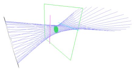 Sturmsches Konoid Augenoptiker Kontaktlinsenspezialist Optometrie